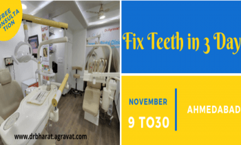 Permanent Fixed Teeth in 3 Days by Dental Implants in Ahmedabad Gujarat India Dr Bharat Agravat