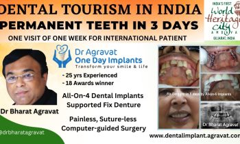Dental Implants Tourism Heritage City Ahmedabad India