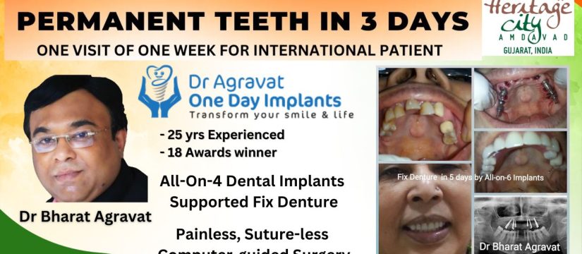 Dental Implants Tourism Heritage City Ahmedabad India