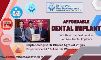 Dental Implants Cost in Ahmedabad Gujarat India Dr Bharat Agravat