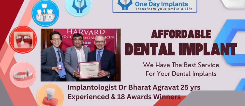 Dental Implants Cost in Ahmedabad Gujarat India Dr Bharat Agravat