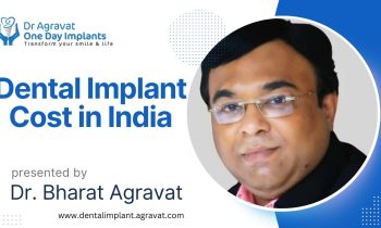 How much does a dental implant cost in India? Dr Bharat Agravat Dental Implants Clinic Ahmedabad Gujarat India