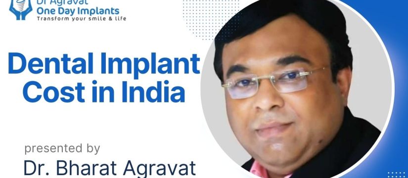 How much does a dental implant cost in India? Dr Bharat Agravat Dental Implants Clinic Ahmedabad Gujarat India