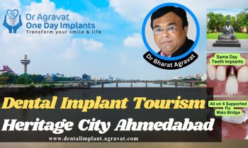 Dental Implants Tourism Heritage City Ahmedabad India Dr Bharat Agravat