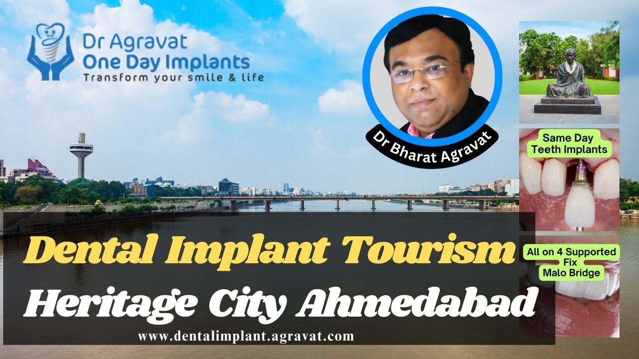 Dental Implants Tourism Heritage City Ahmedabad India Dr Bharat Agravat