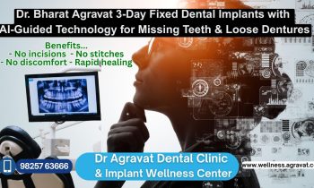 Fixed Teeth in 3 Days by Dental Implants