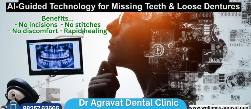 Fixed Teeth in 3 Days by Dental Implants