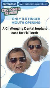 OLI Therapy Mouth Opening & Fixed Teeth by Dental Implants