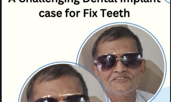 OLI Therapy Mouth Opening & Fixed Teeth by Dental Implants